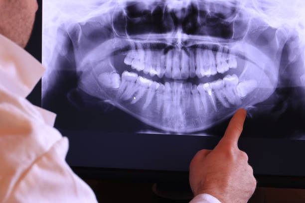Best Emergency Dentist for Knocked-Out Tooth in Dunstan, ME